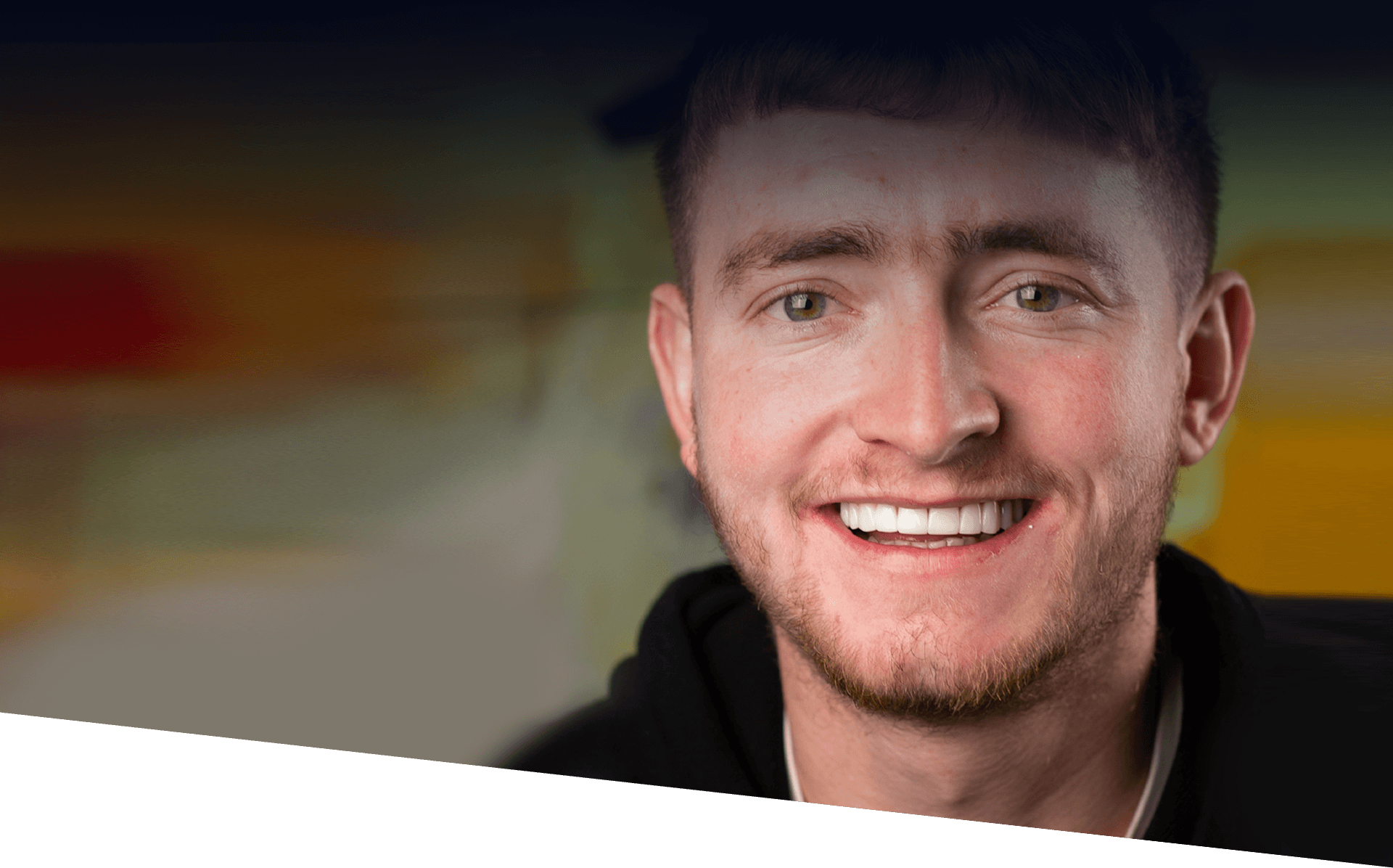 Smile Transformation