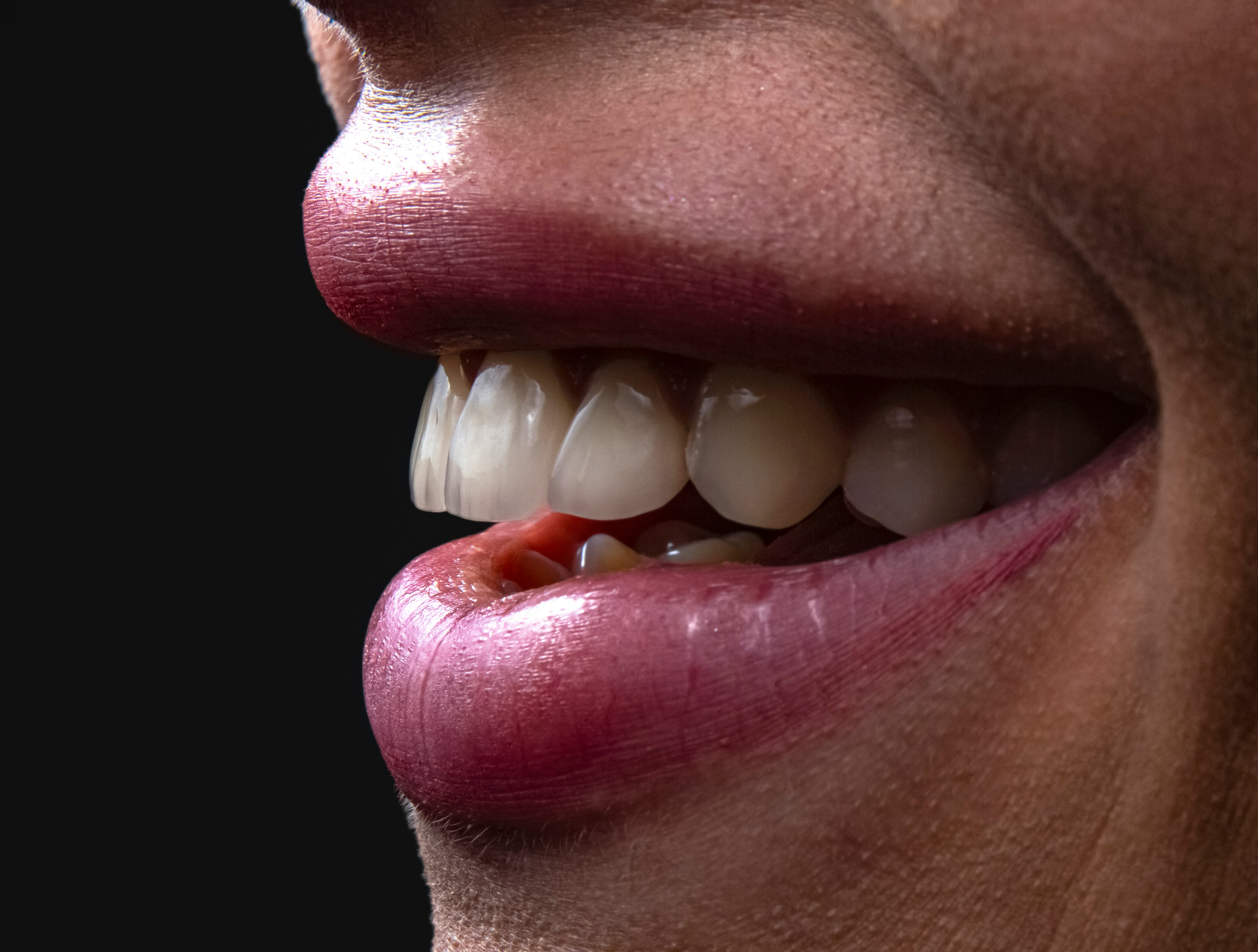 Smile Transformation
